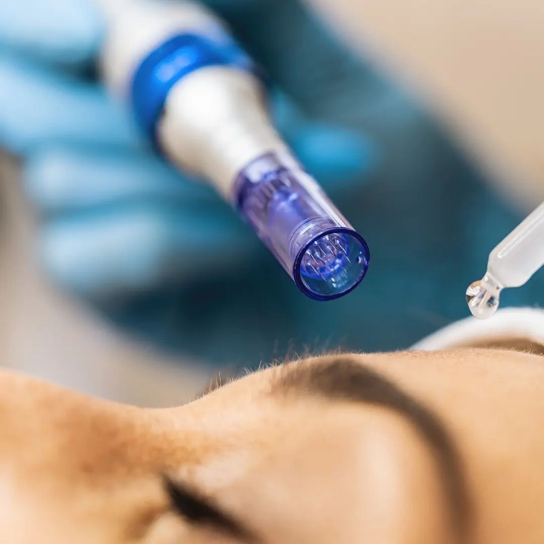 Microneedling - Vanity concept 01